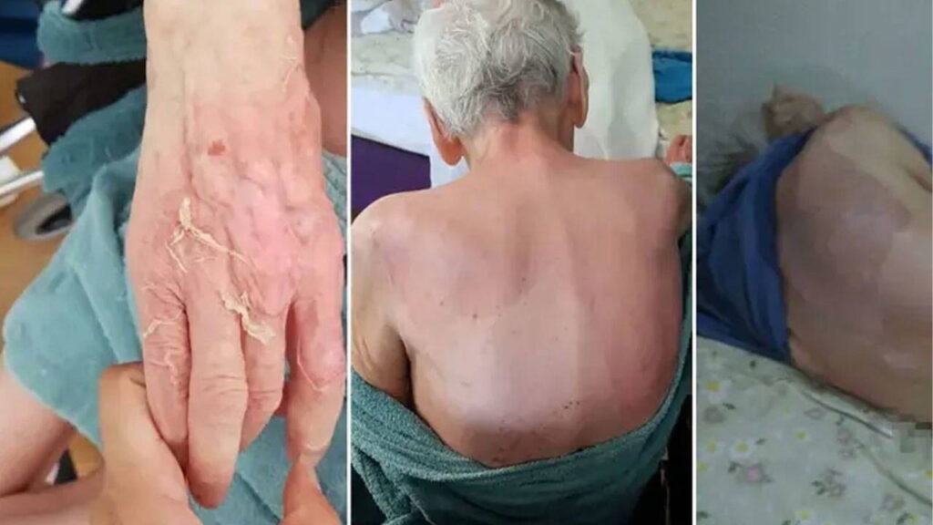 Huzurevi Doktoruna Taksirle Ölüm Cezası: 21 Bin Lira